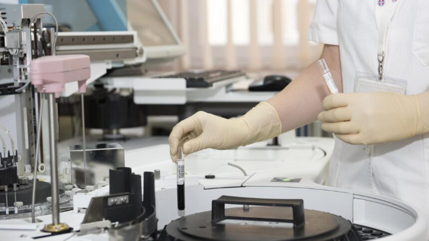 sapte focare de hepatita a confirmate intr un judet din romania aproape 150 de imbolnaviri si sute de persoane monitorizate 68dbc46e71dc5