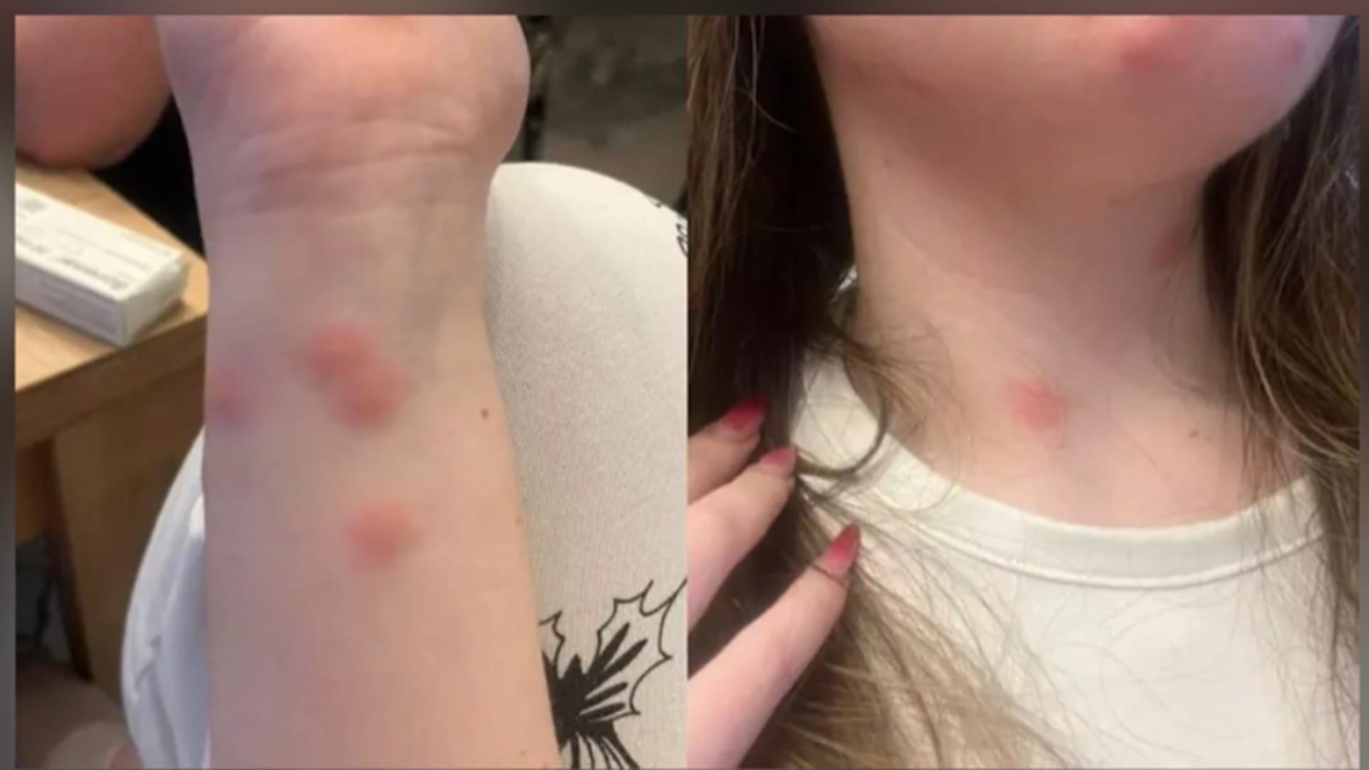 conditii jalnice in trenul bucuresti sighet o tanara a ajuns la spital dupa ce a fost muscata de plosnite intr un vagon cuseta 69232a9a7758b